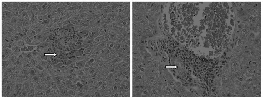 A kind of construction method of the mouse model of hepatitis B virus infection