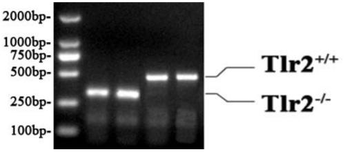 A kind of construction method of the mouse model of hepatitis B virus infection