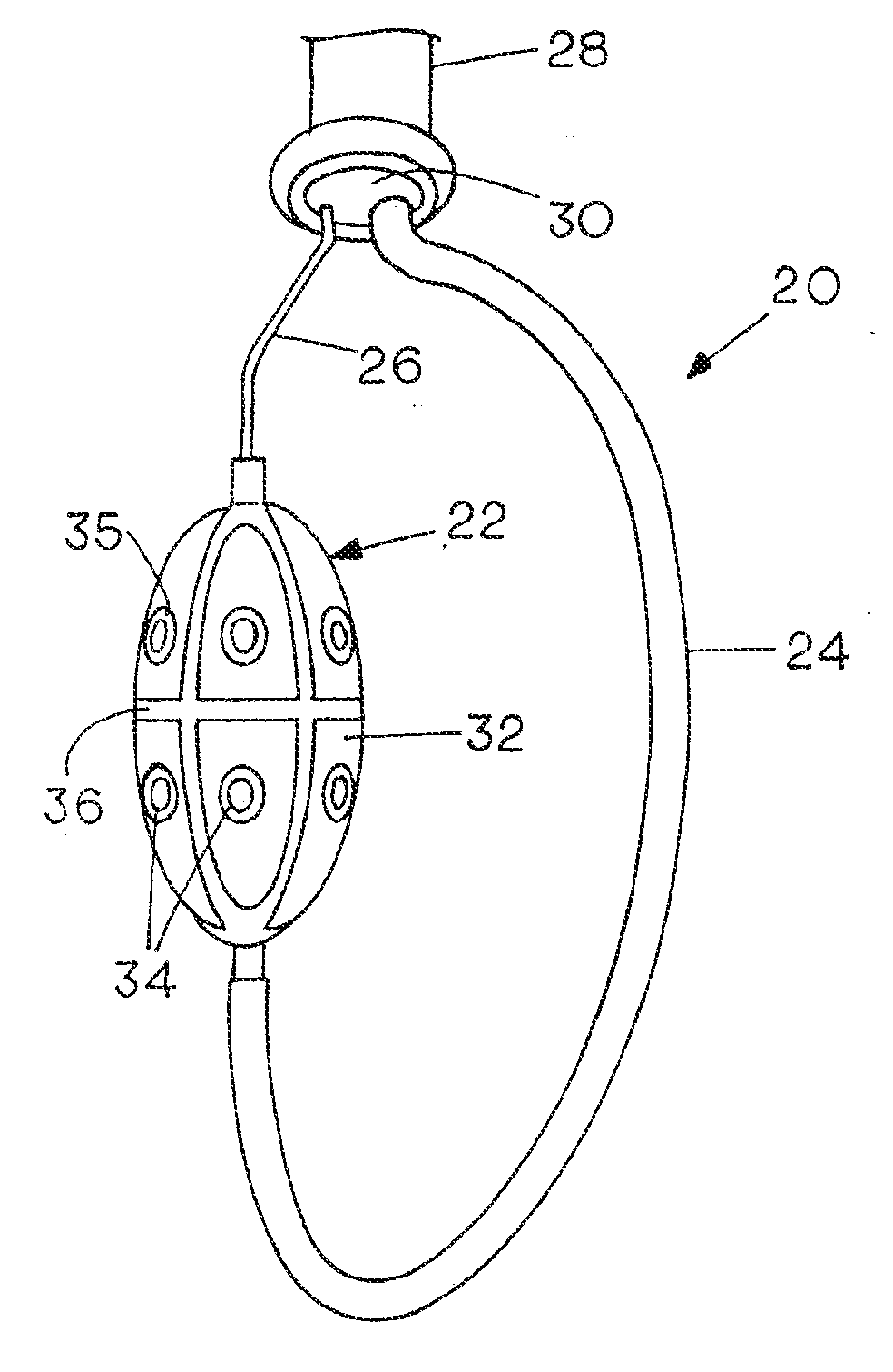 Catheter Systems for Cardiac Arrhythmia Ablation