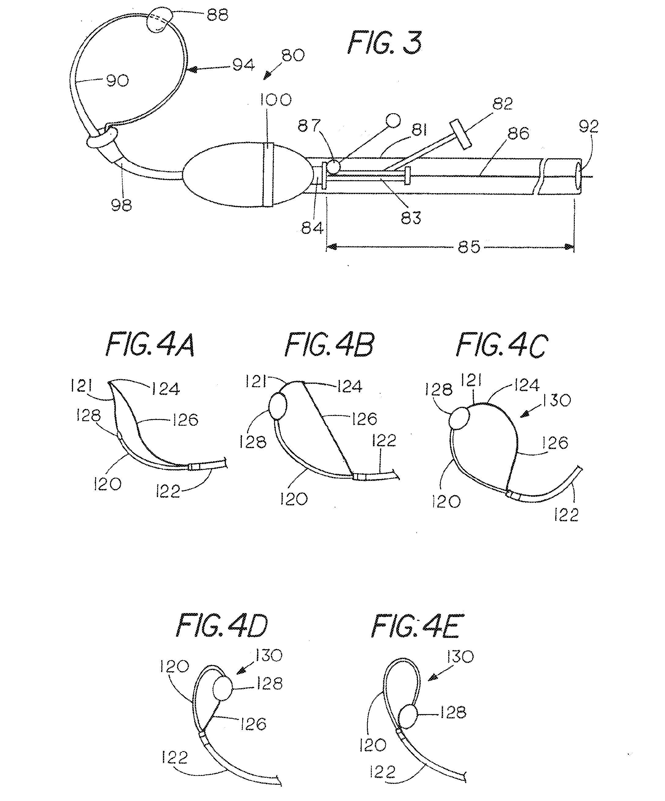 Catheter Systems for Cardiac Arrhythmia Ablation