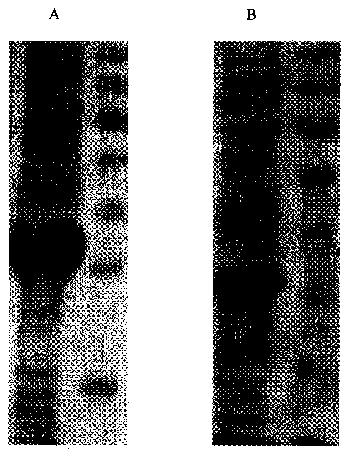 Method for synthesizing bilirubin by utilizing immobilized enzyme