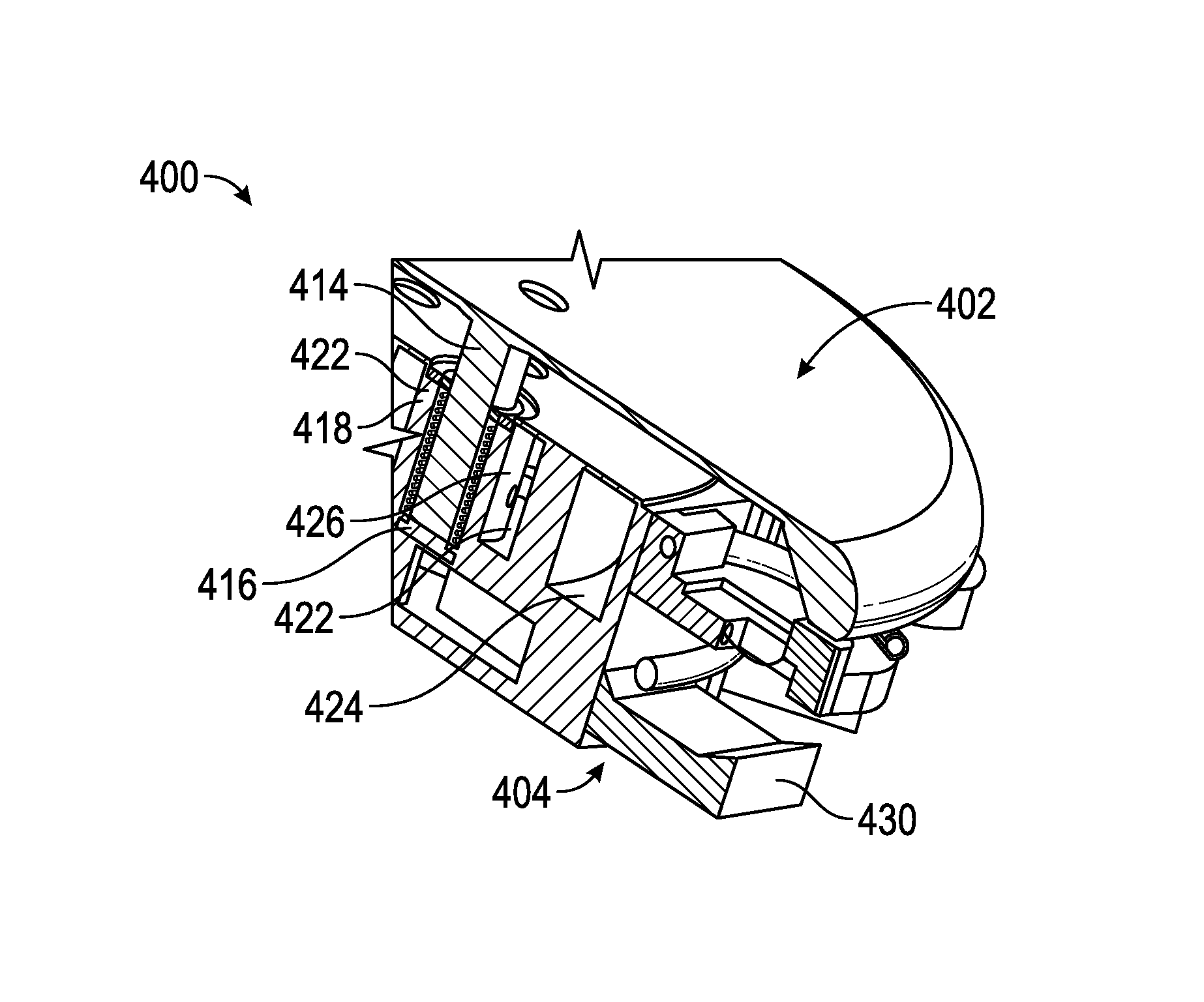 Method and apparatus for minimally invasive heart valve procedures