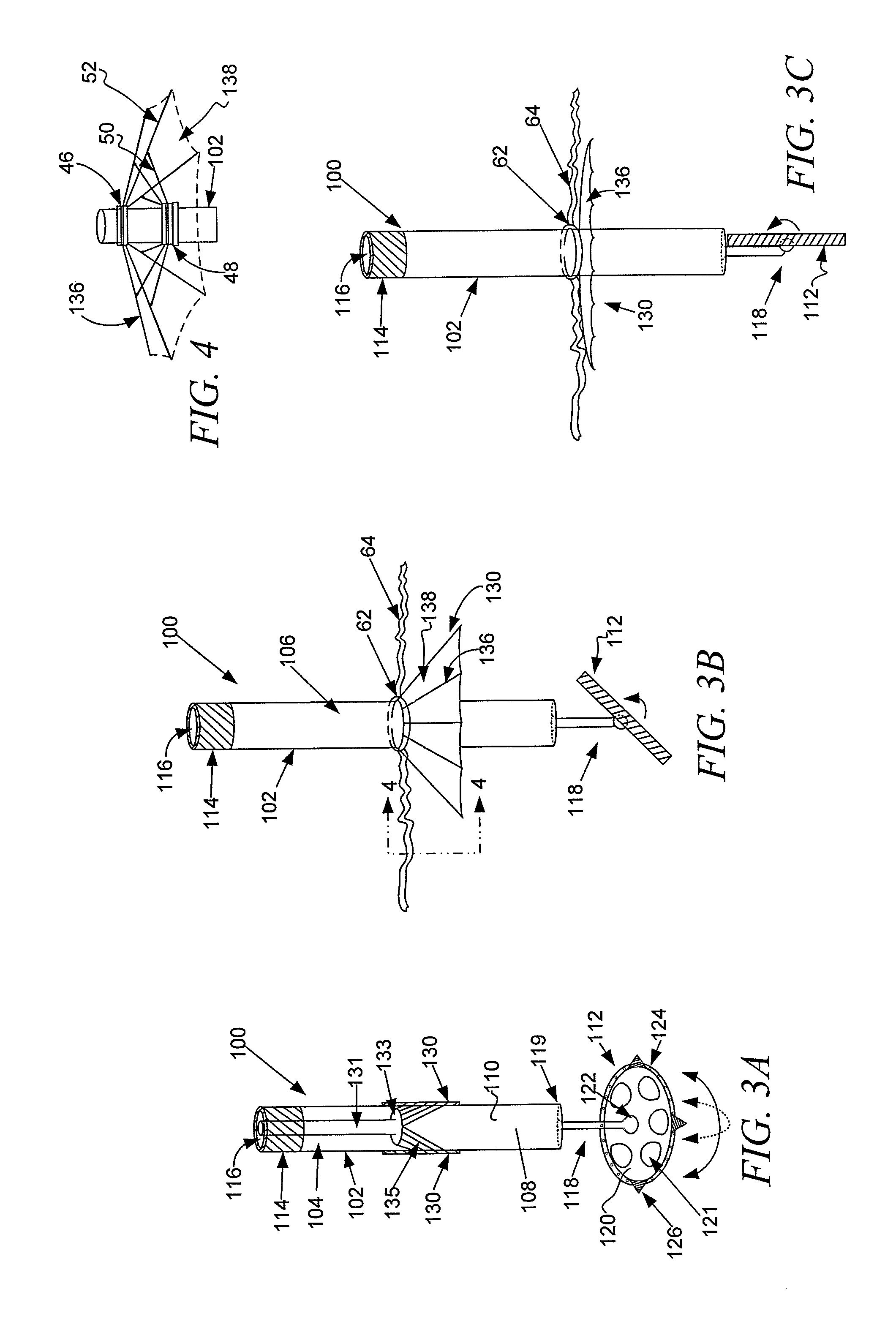 Method and apparatus for minimally invasive heart valve procedures