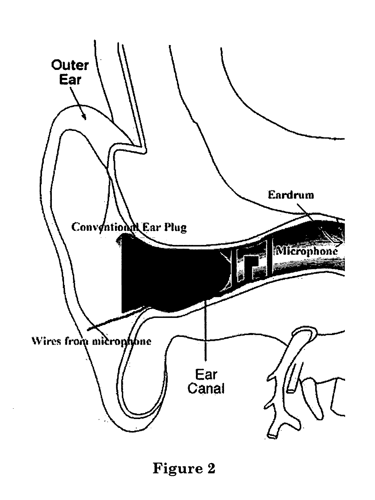 Method and apparatus for continuous noise exposure monitoring