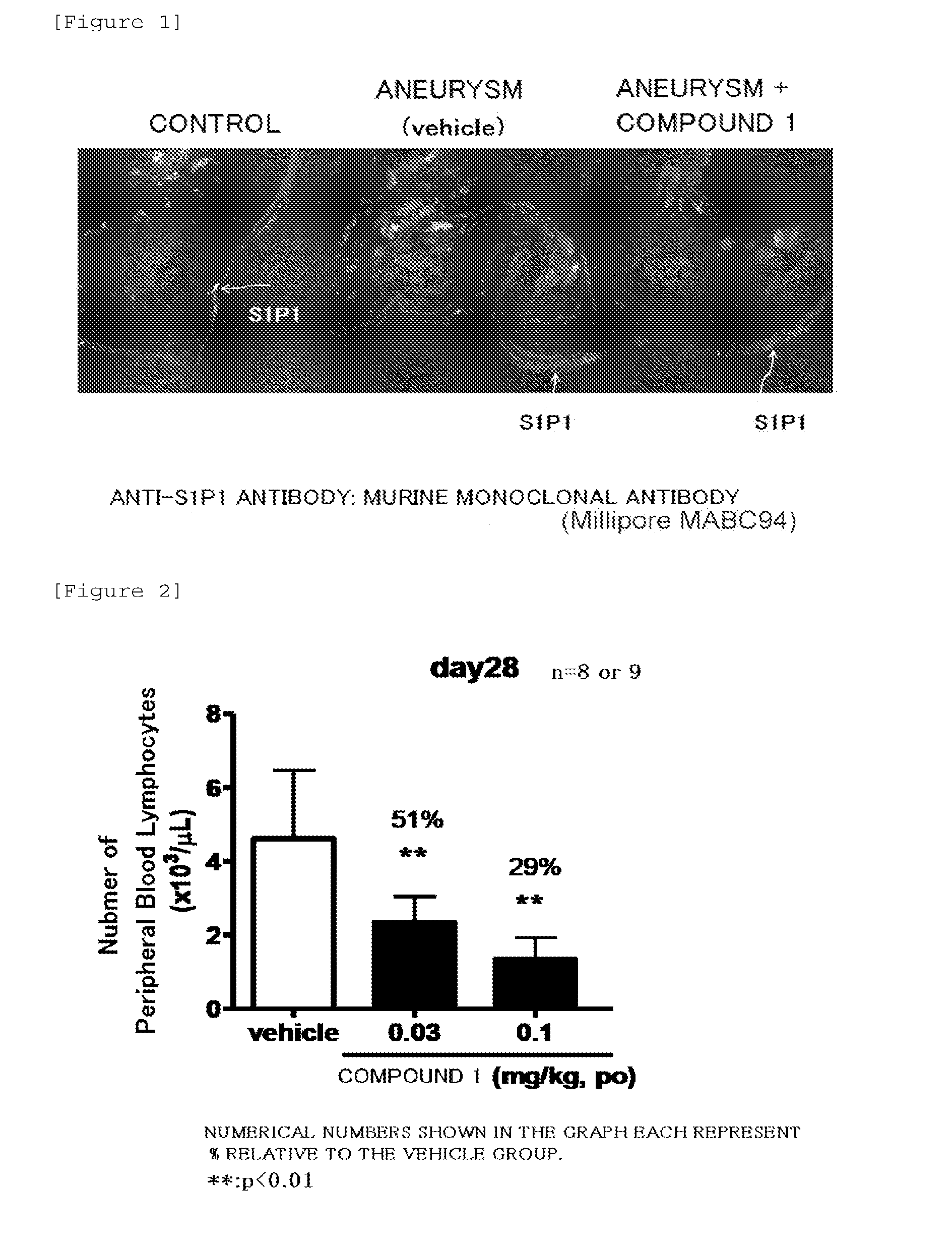 Medicinal composition for inhibiting formation and/or enlargement of cerebral aneurysm or shrinking same