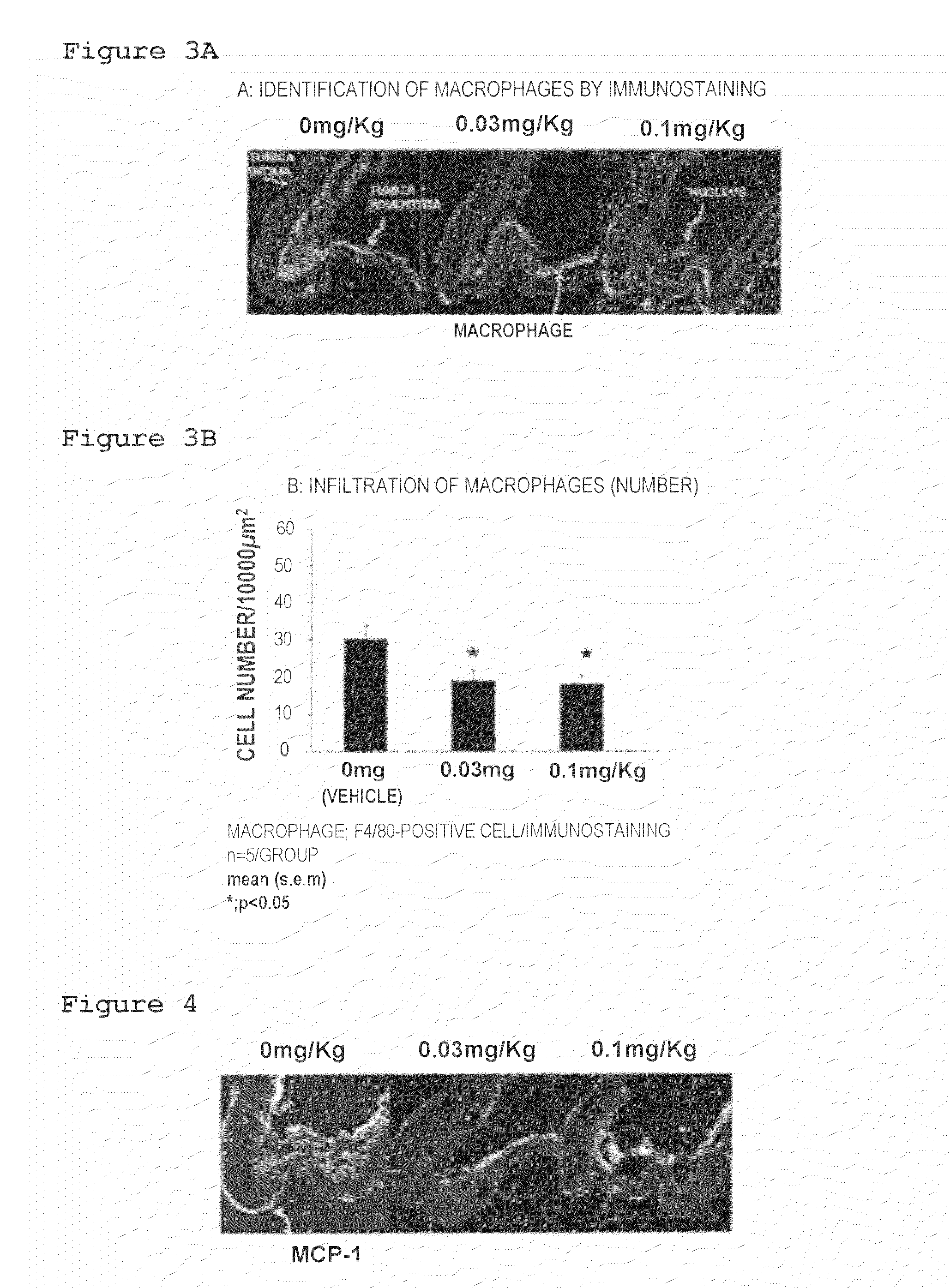 Medicinal composition for inhibiting formation and/or enlargement of cerebral aneurysm or shrinking same