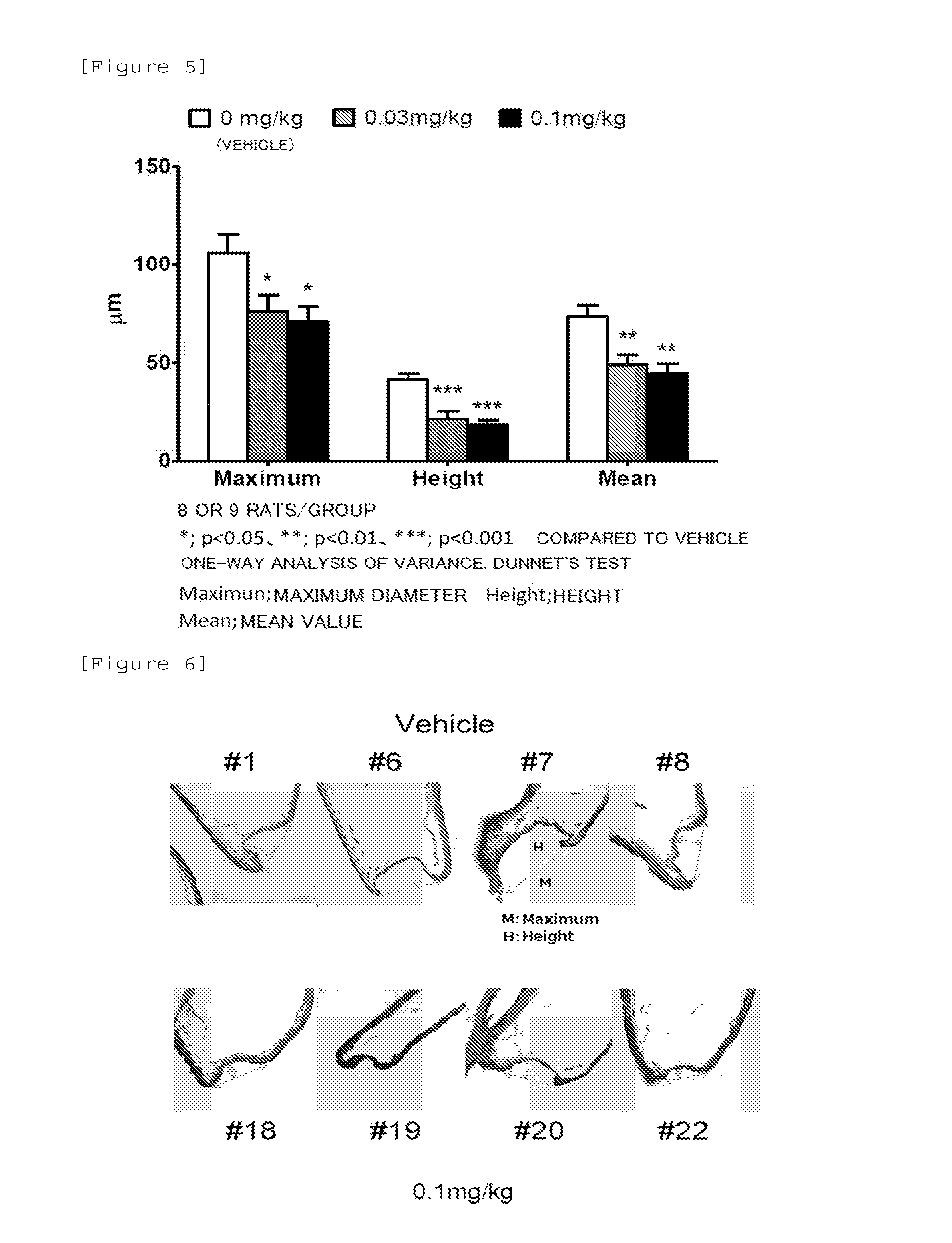 Medicinal composition for inhibiting formation and/or enlargement of cerebral aneurysm or shrinking same