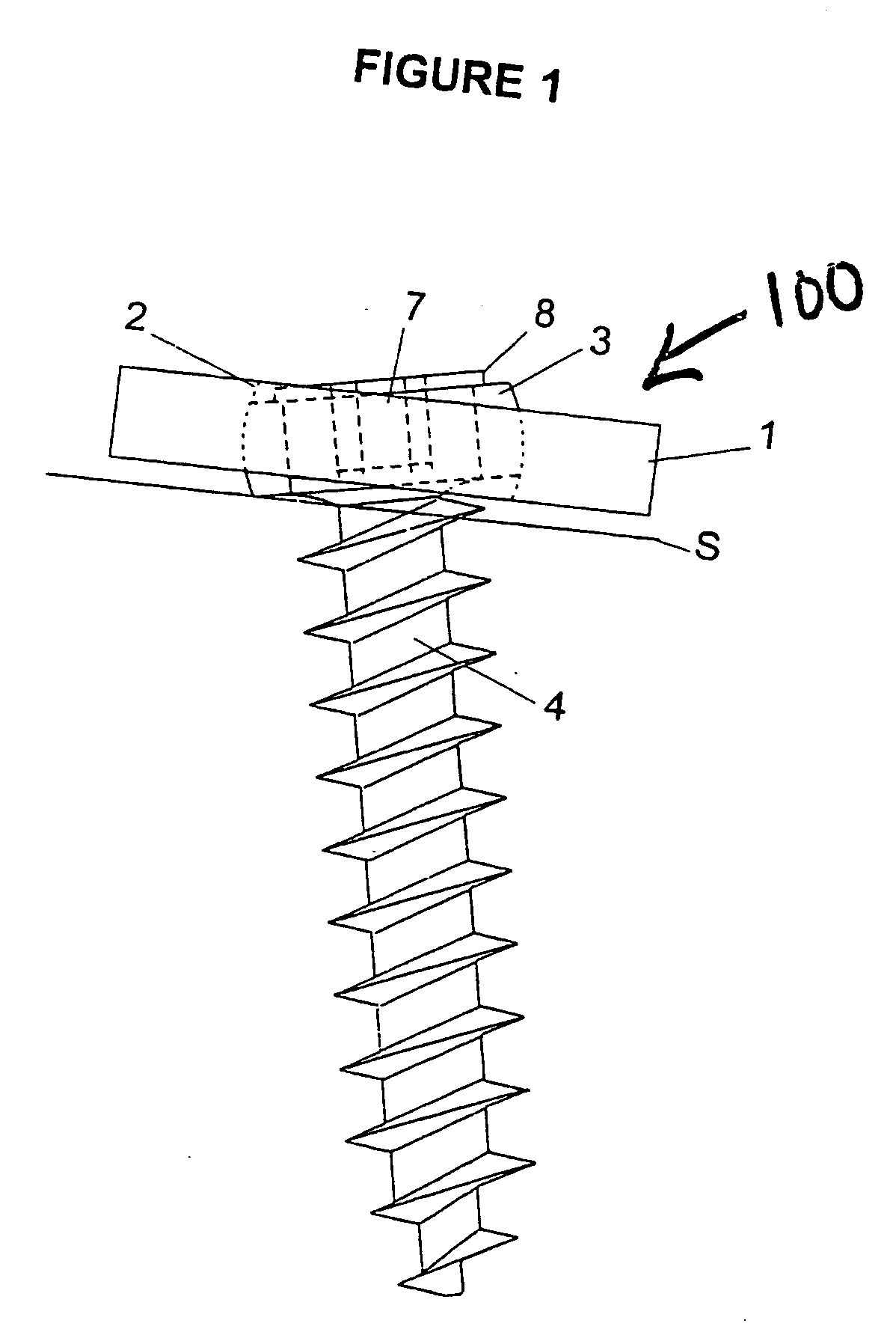 Device for connecting a screw to a support plate