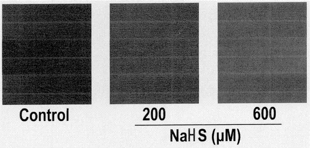 A new method for detecting the activity of hydrogen sulfide synthase with a fluorescent probe of hydrogen sulfide and its application