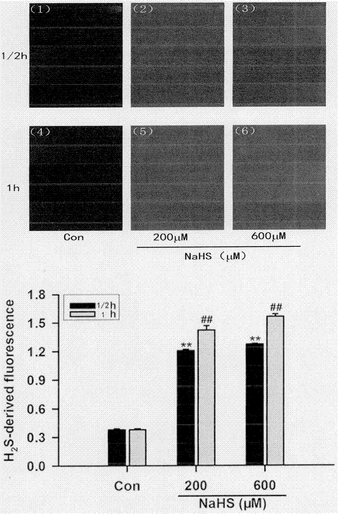 A new method for detecting the activity of hydrogen sulfide synthase with a fluorescent probe of hydrogen sulfide and its application