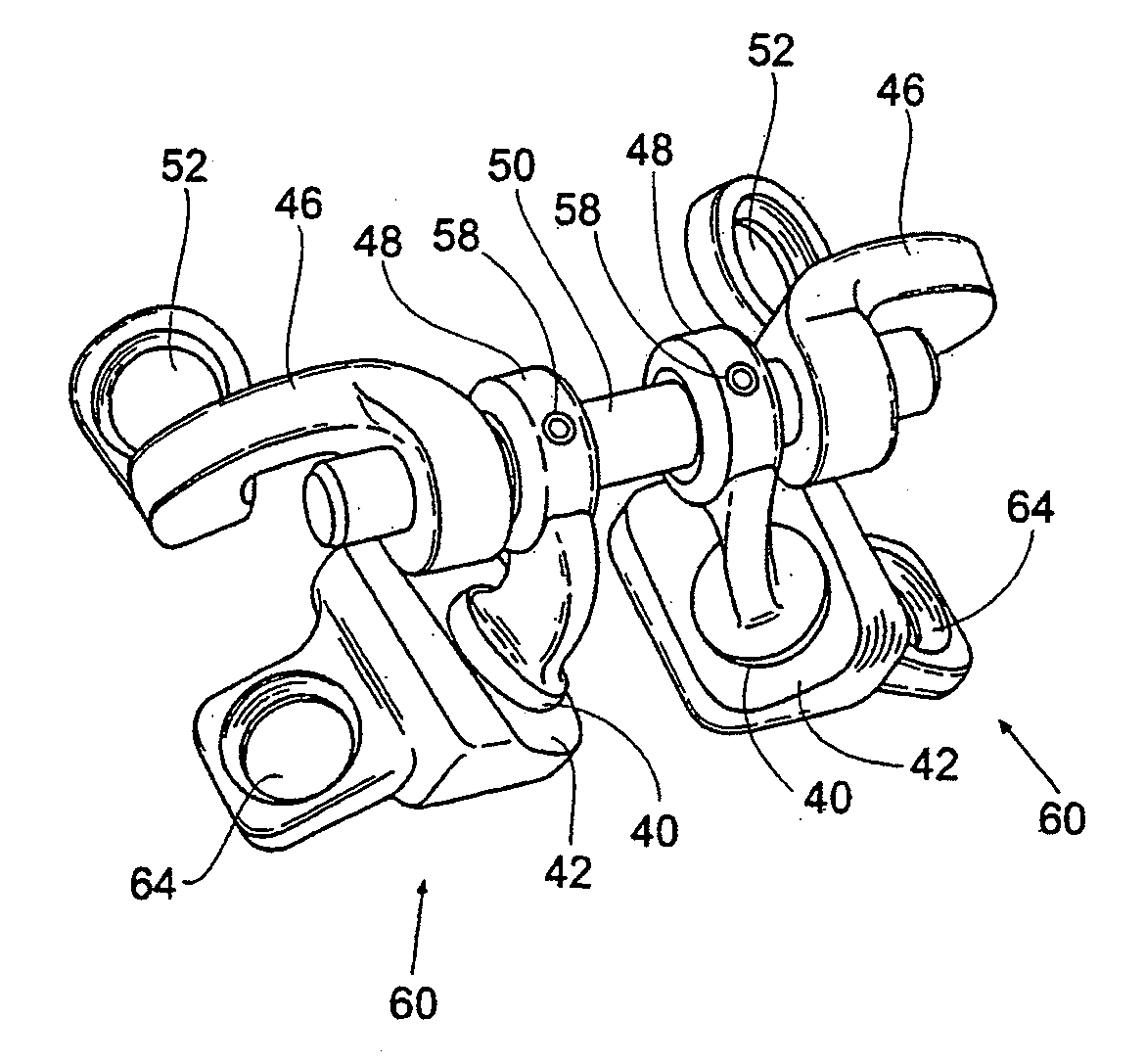 Prostheses systems and methods for replacement of natural facet joints with artificial facet joint surfaces