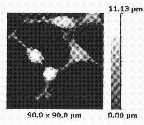 Device and method for evaluating malignancy degree of neuroblastoma