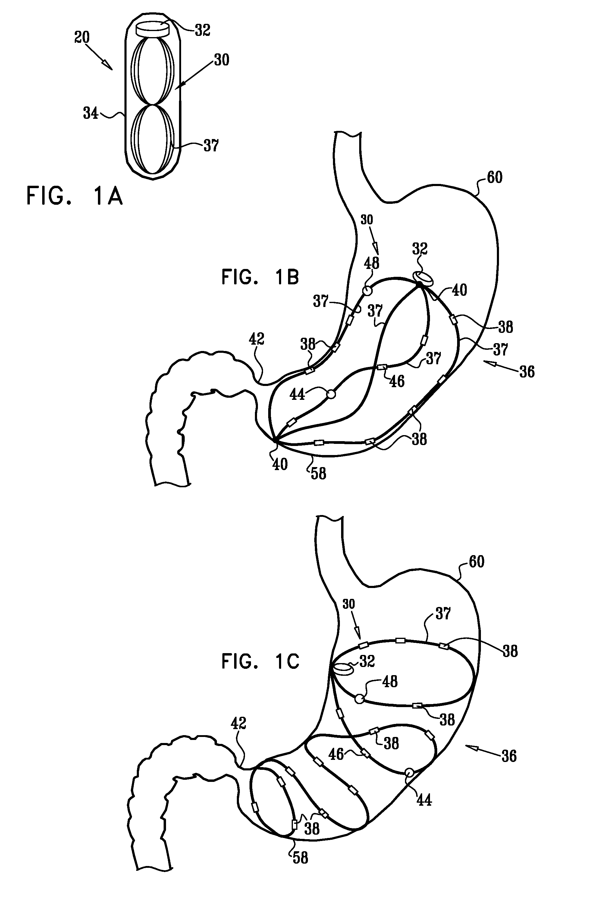 Ingestible capsule for appetite regulation