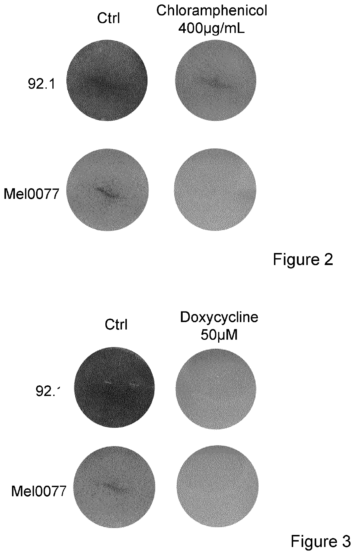 Uveal melanoma treatment