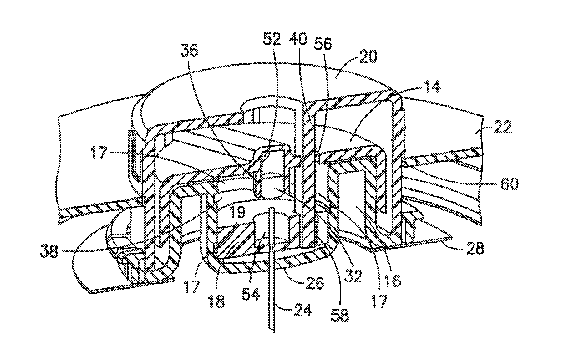 Adjustable Height Needle Infusion Device