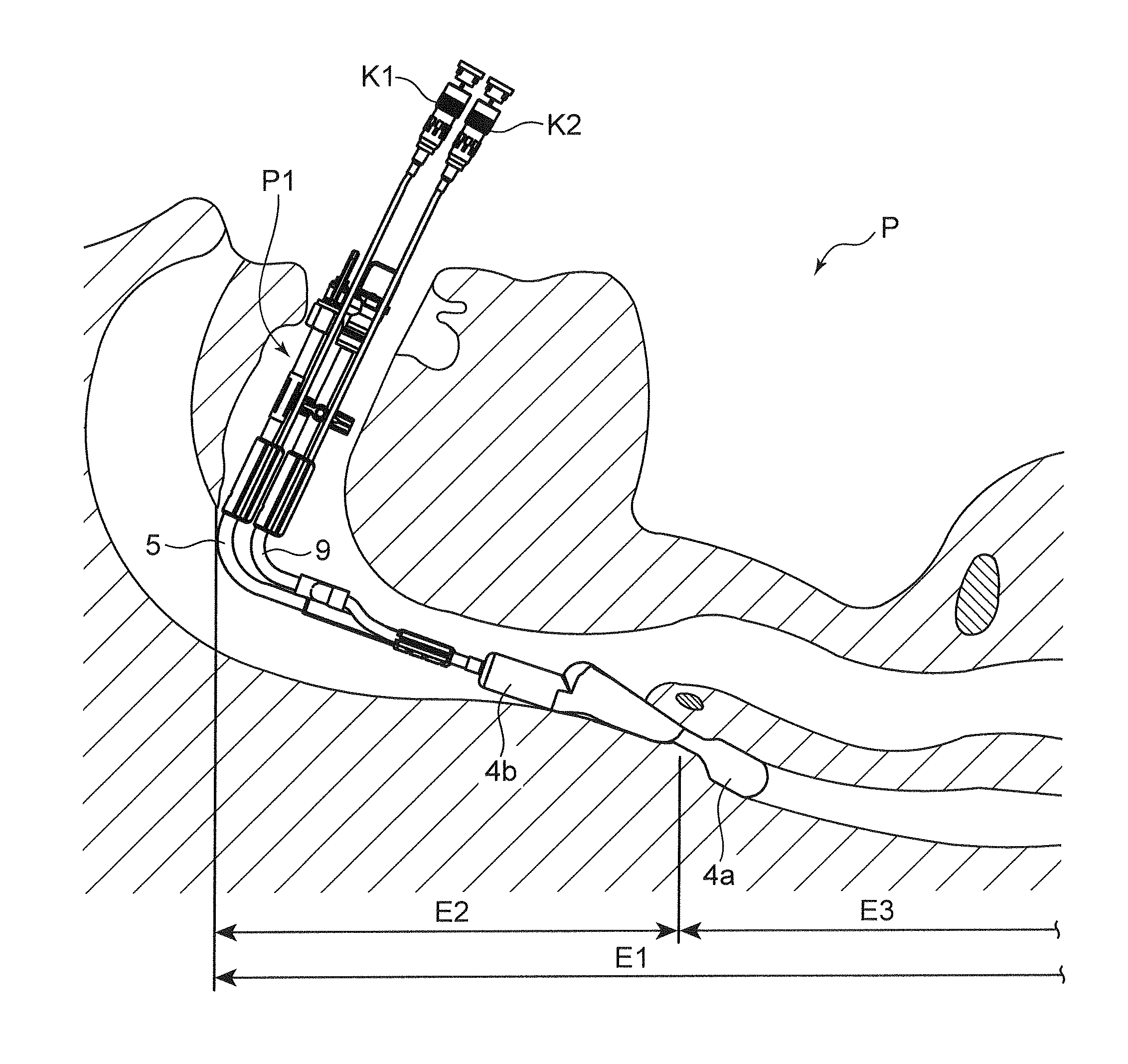 Brain cooling apparatus and brain cooling device suitable thereto