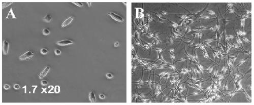 A method for preparing composite film for treating vitiligo by using autologous hair follicle melanocytes