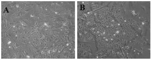 A method for preparing composite film for treating vitiligo by using autologous hair follicle melanocytes