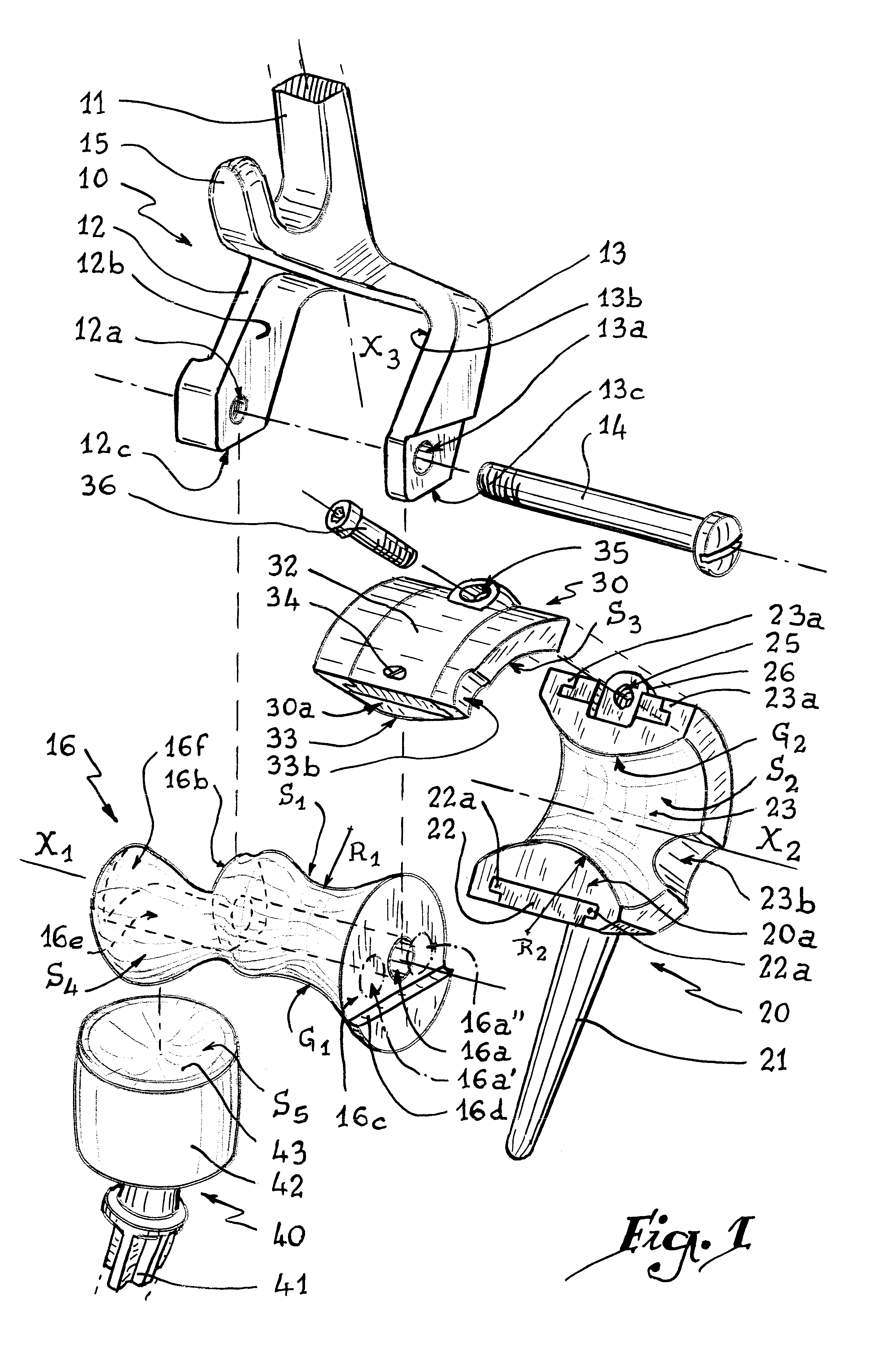 Elbow prosthesis