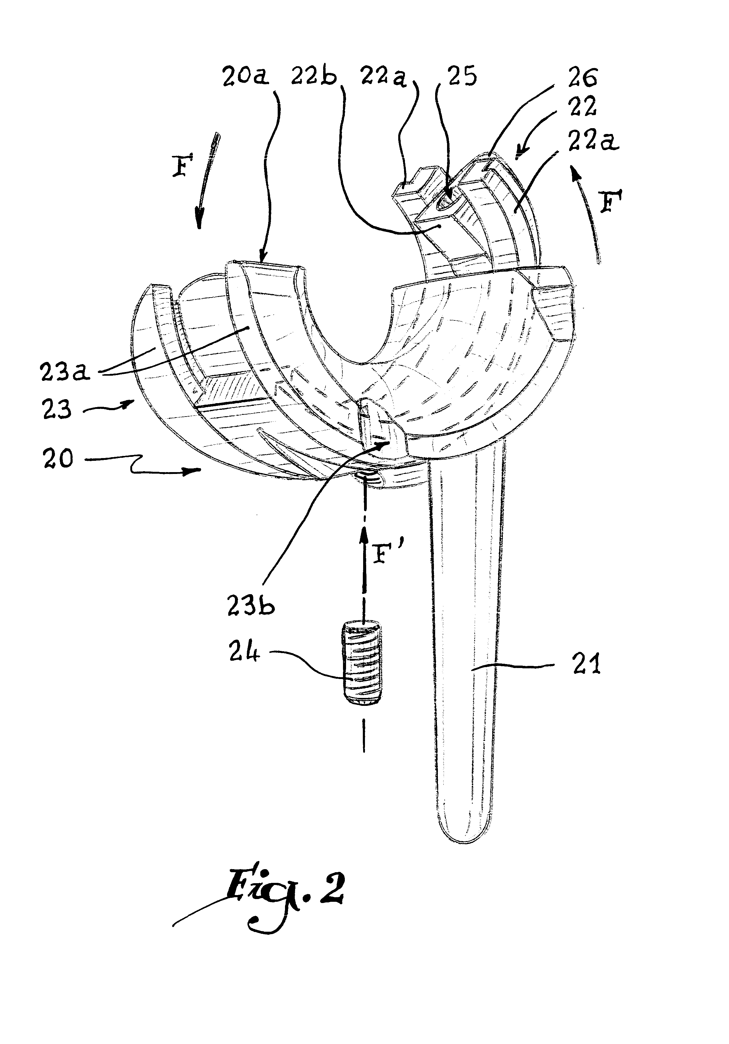 Elbow prosthesis