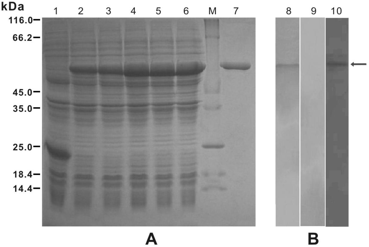 38kDa antigen for Baylisascaris schroederi of giant pandas, preparation method for antigen and application of antigen