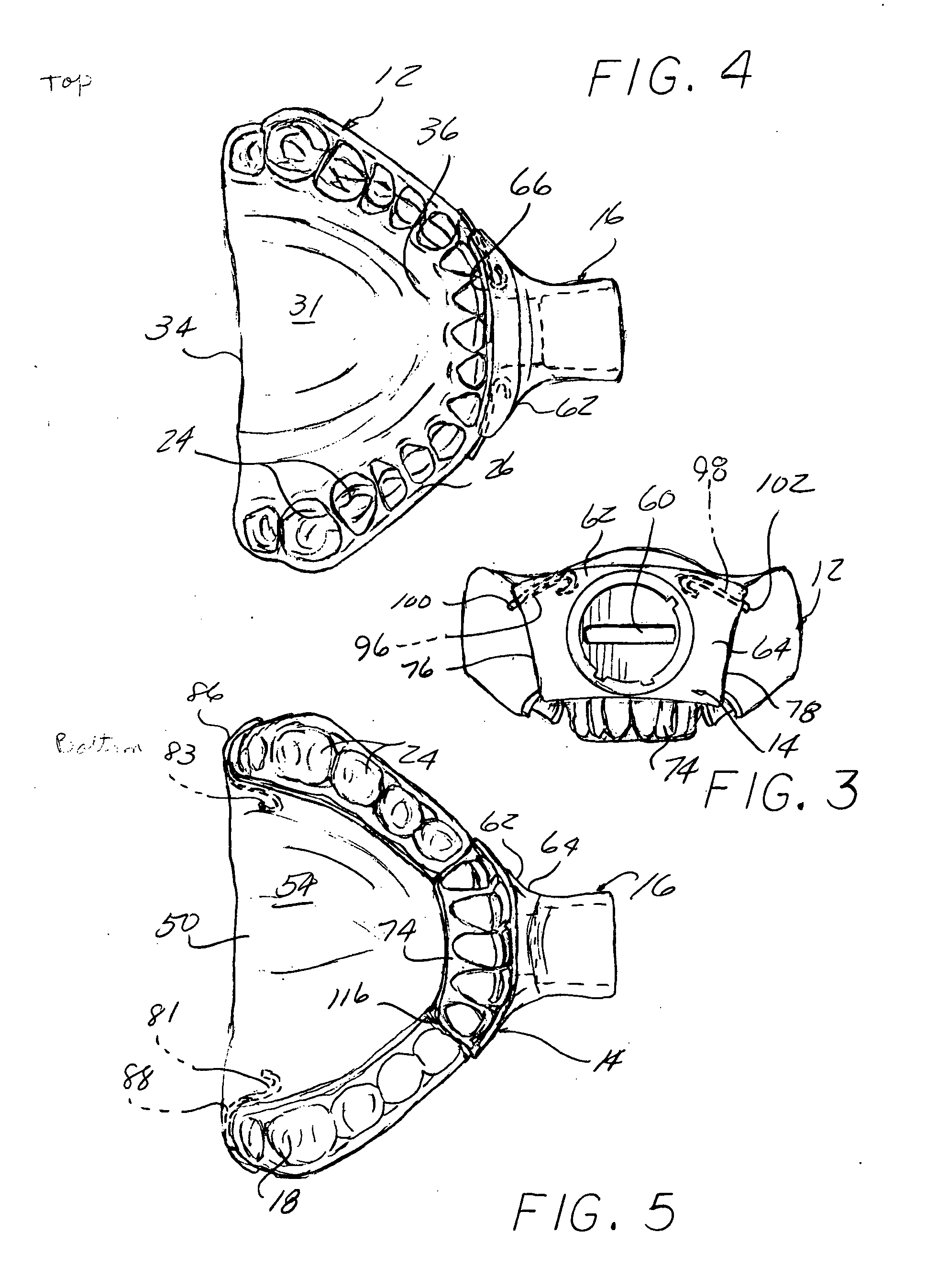 Method and device for addressing sleep apnea and related breathing disorders