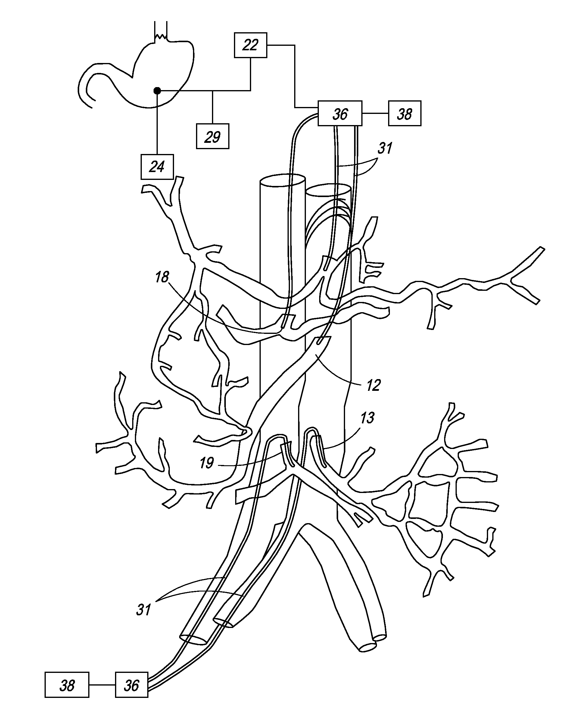 Method and apparatus for stimulating the vascular system