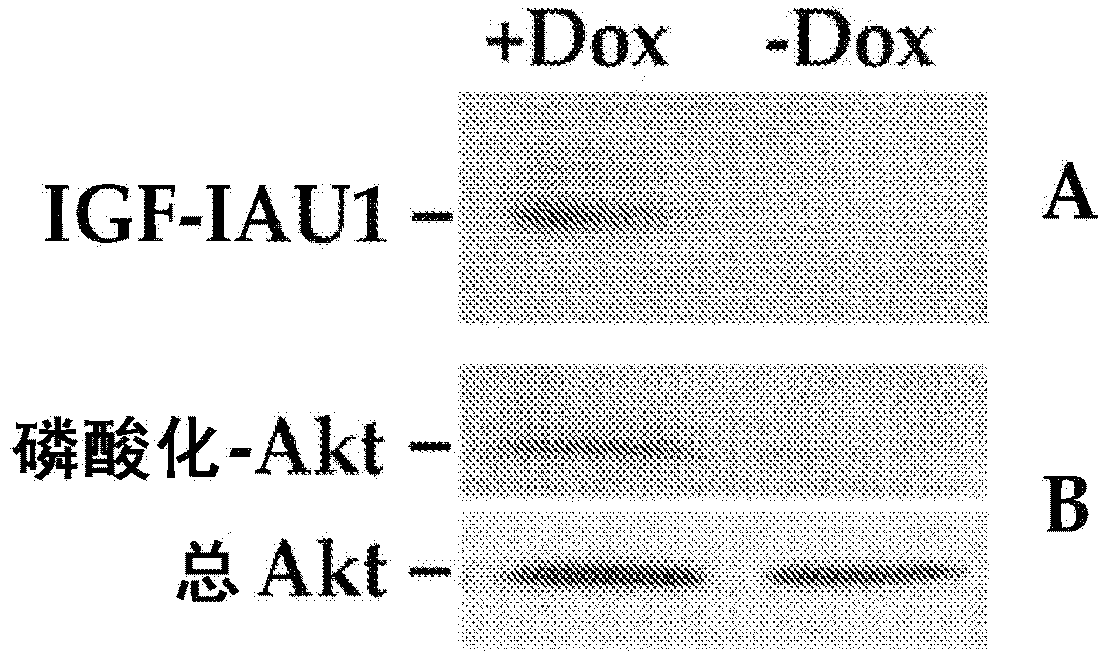 Systemic delivery and regulated expression of paracrine genes for cardiovascular diseases and other conditions