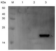 sHSPs recombinant invasive lactobacillus plantarum live vector DNA vaccine