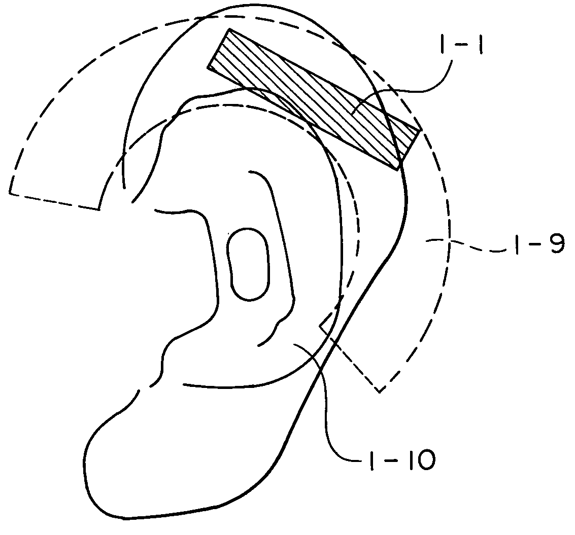 Acoustic vibration generating element