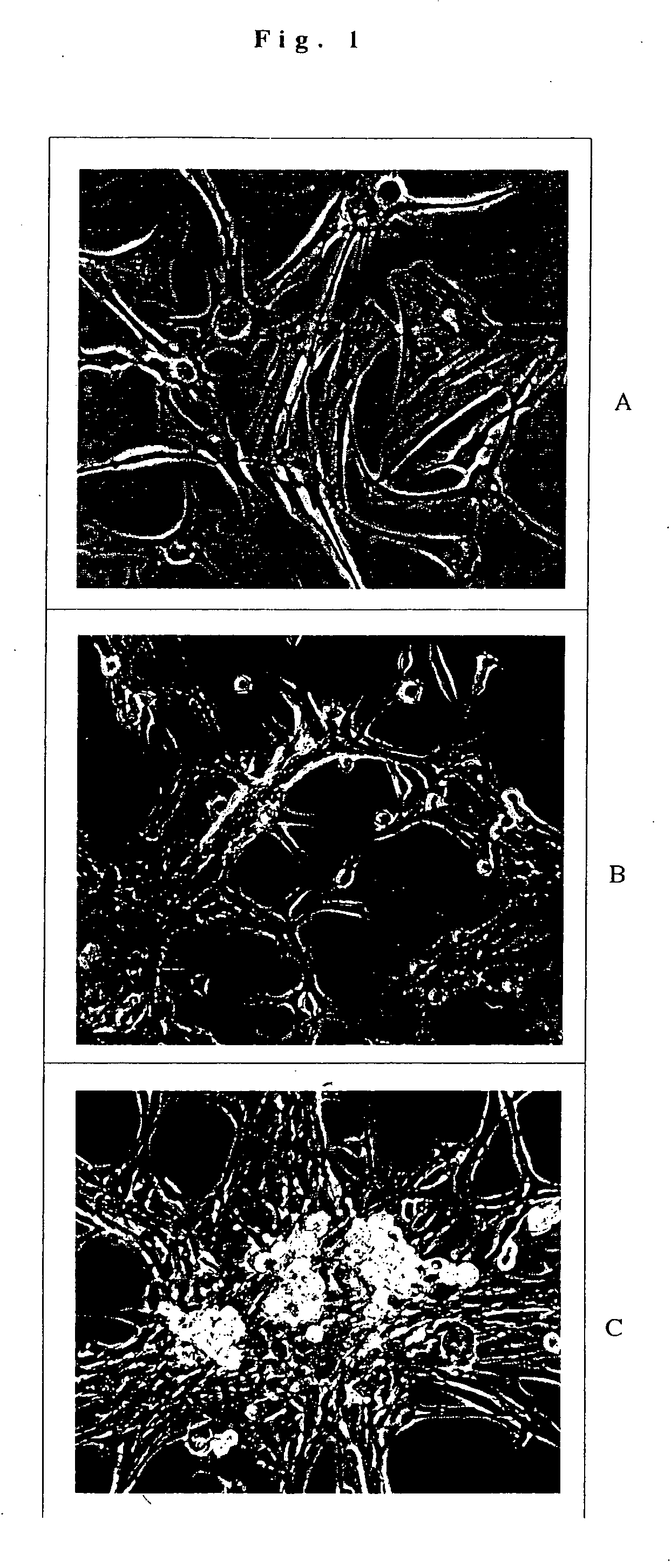 Transdifferentiation of glial cells