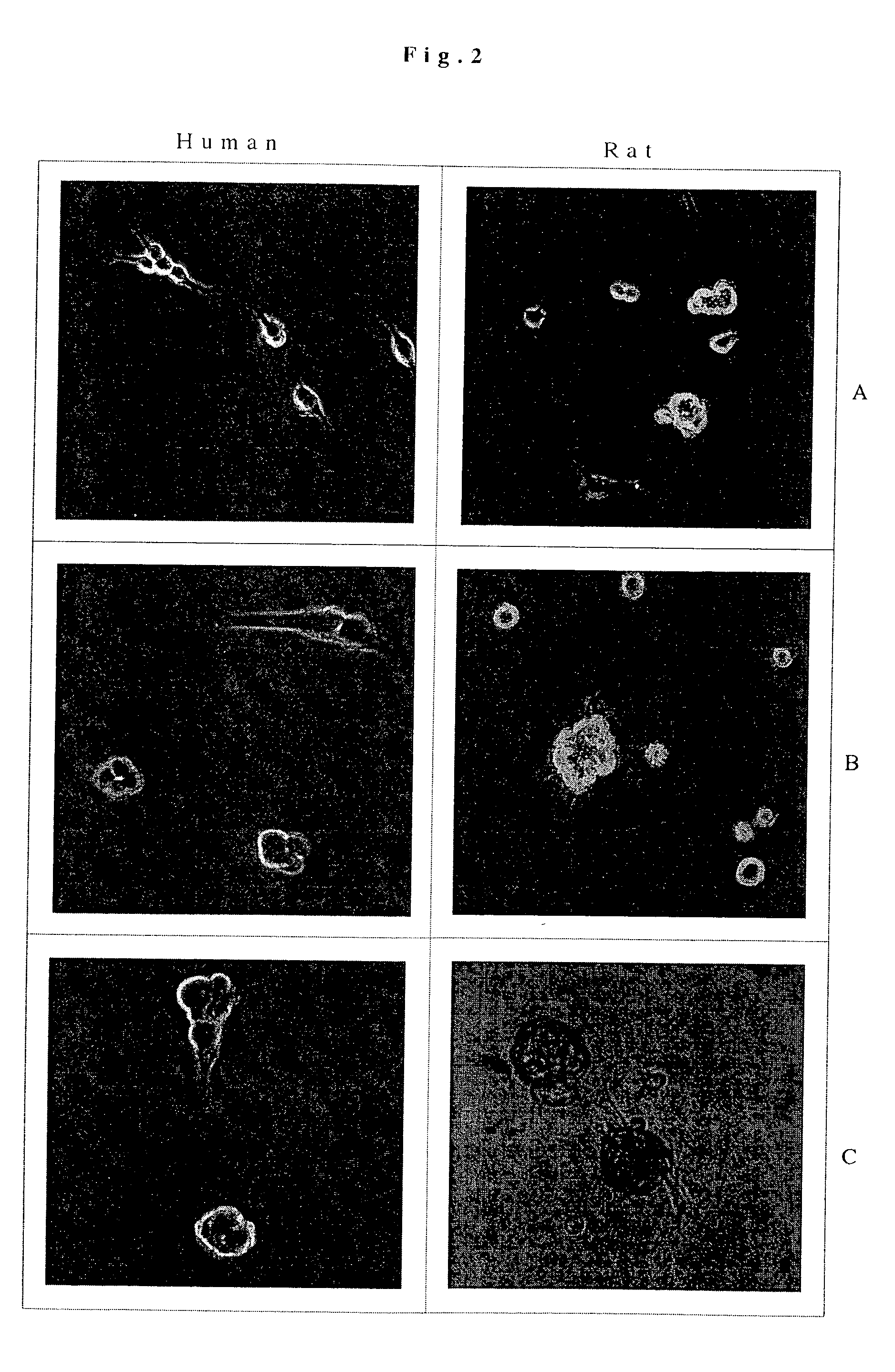 Transdifferentiation of glial cells