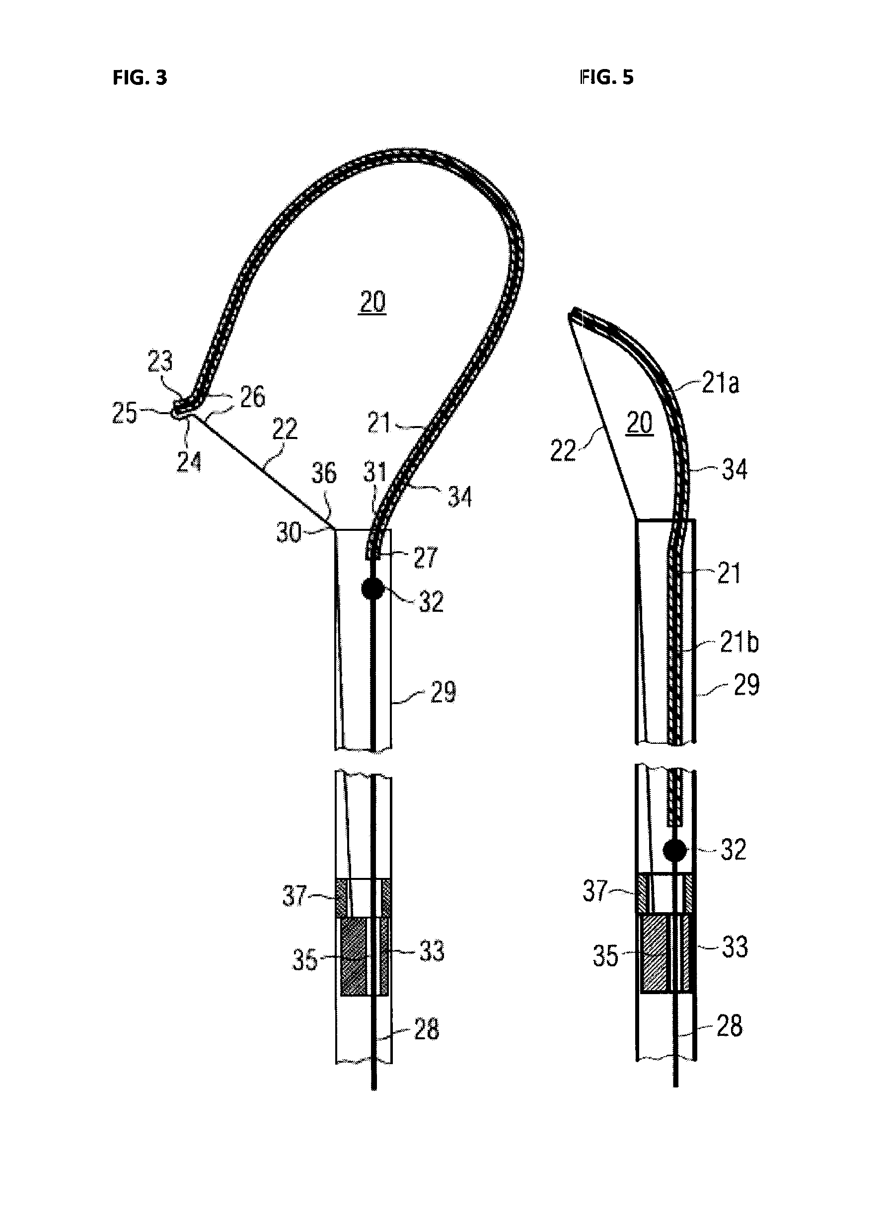 Monopolar RF-Surgical Snares