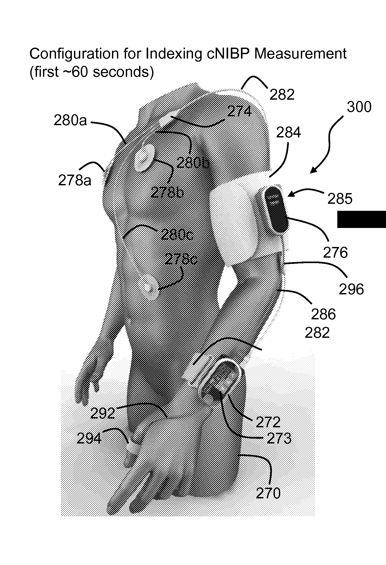 BODY-WORN SYSTEM FOR MEASURING CONTINUOUS NON-INVASIVE BLOOD PRESSURE (cNIBP)