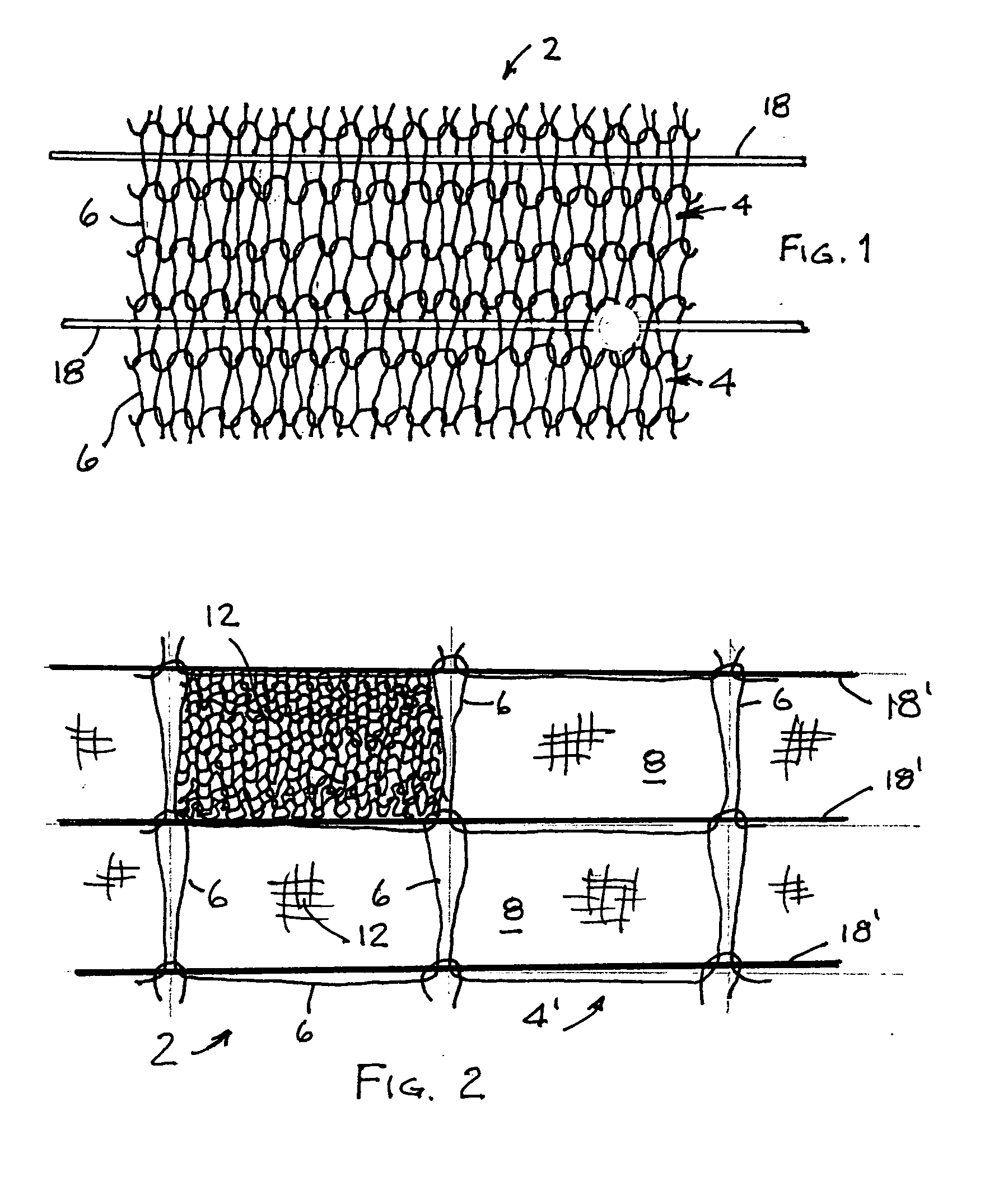 Laminated casing having multiple porosities