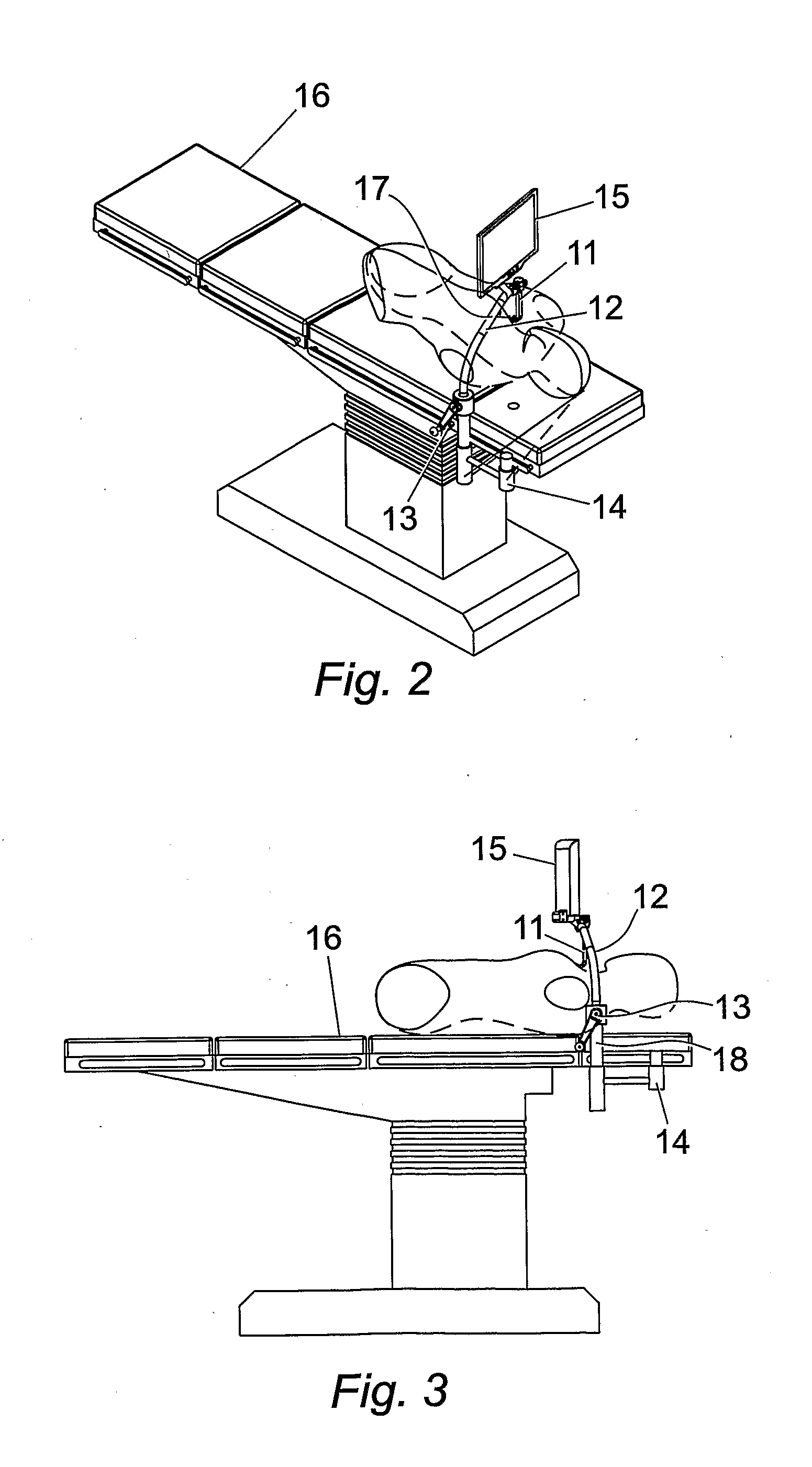 Retractor