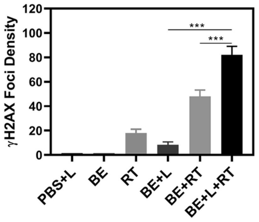 Tumor targeting carrier for low-dose radiotherapy, preparation method of tumor targeting drug and tumor targeting drug