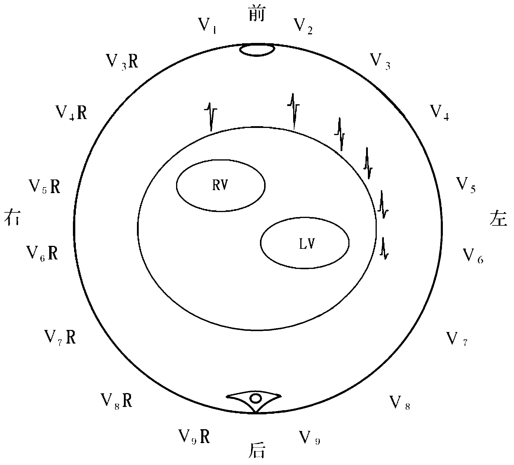 Cardiac electric axis and clockwise transposition measuring tray