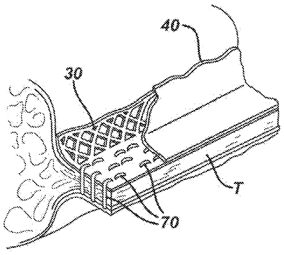 Woven and fibrous materials for reinforcing staple threads