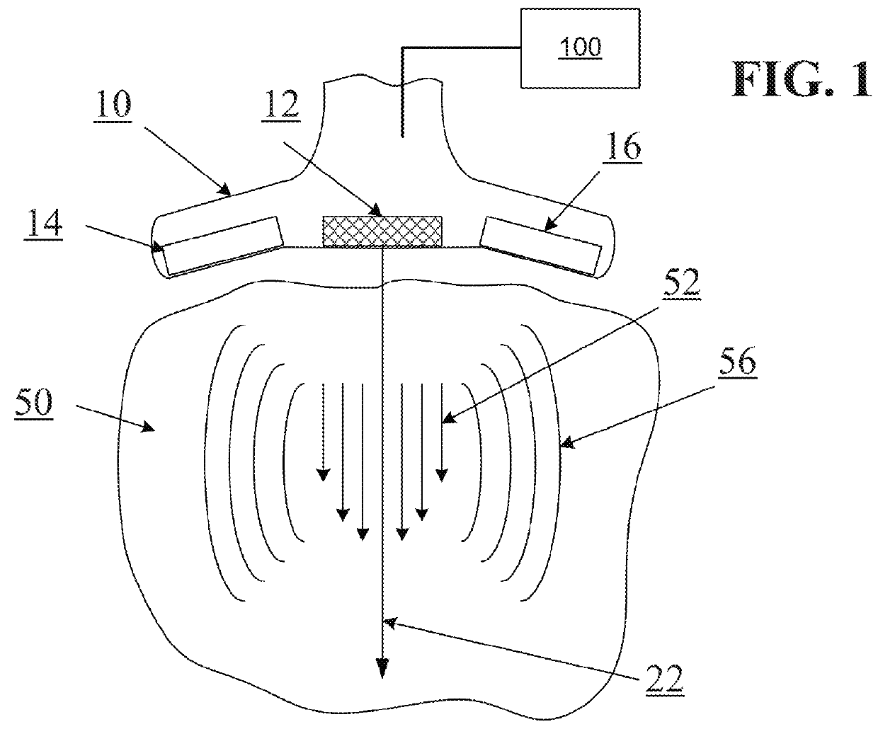 Determining material stiffness using multiple aperture ultrasound