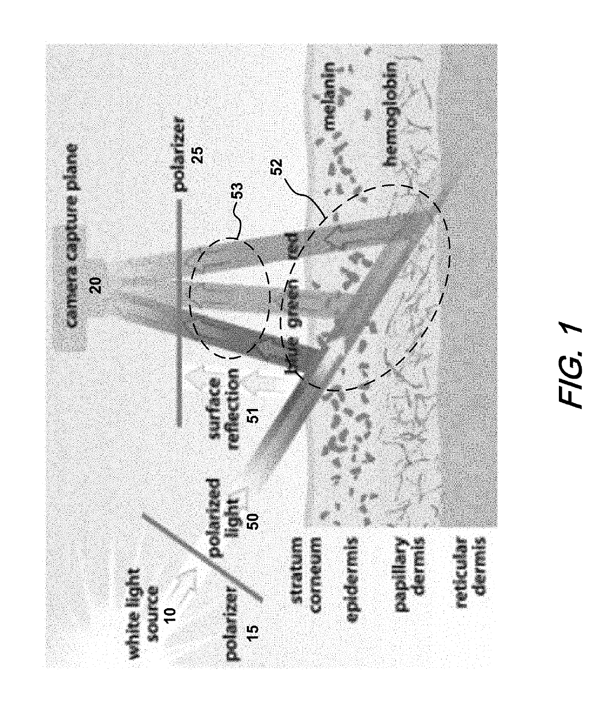 Enhancing pigmentation in dermoscopy images