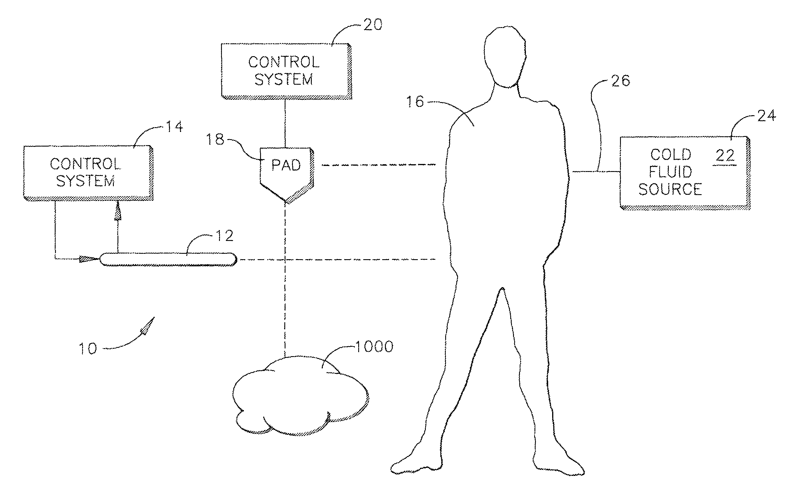 External heat exchange pad for patient