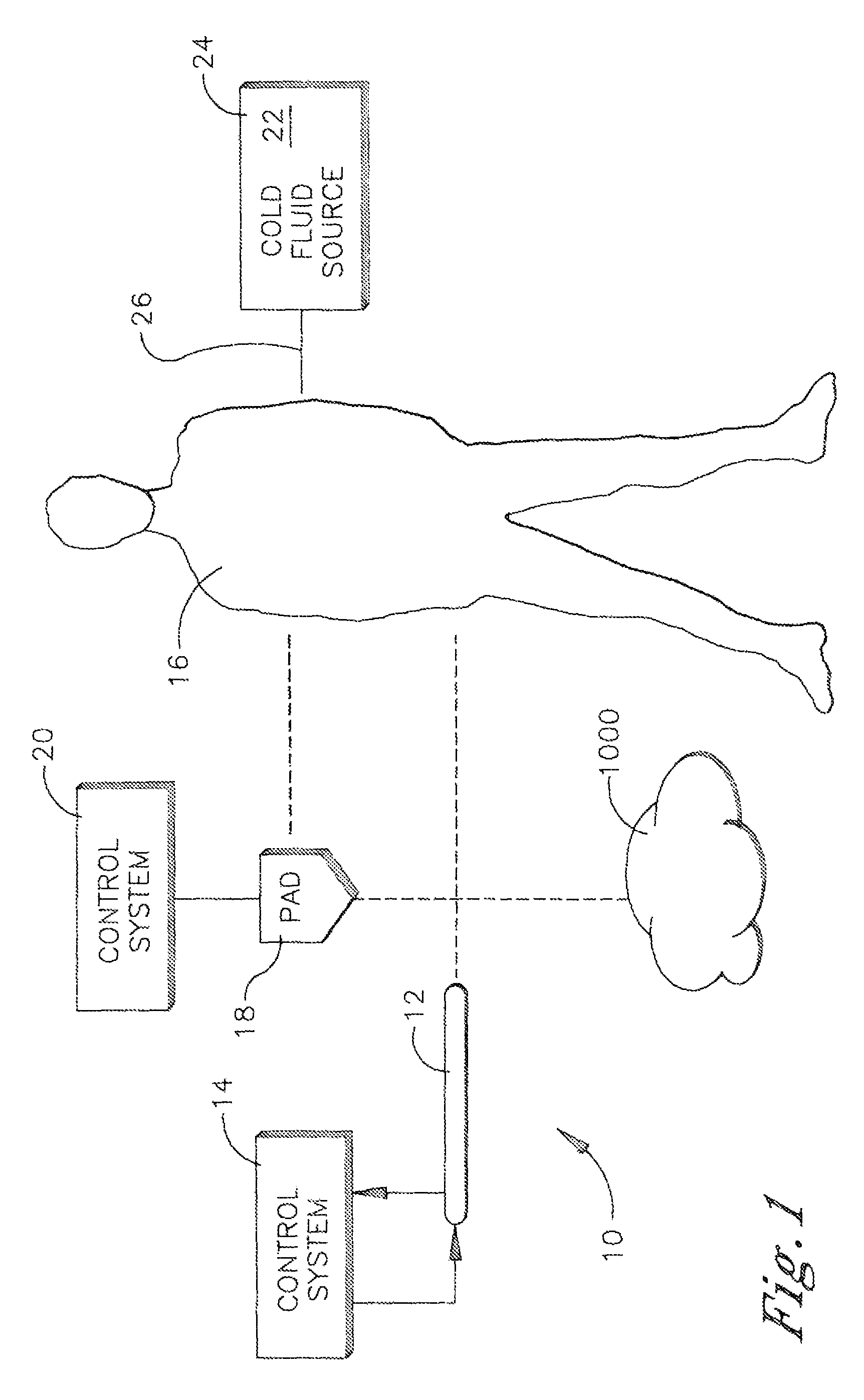 External heat exchange pad for patient