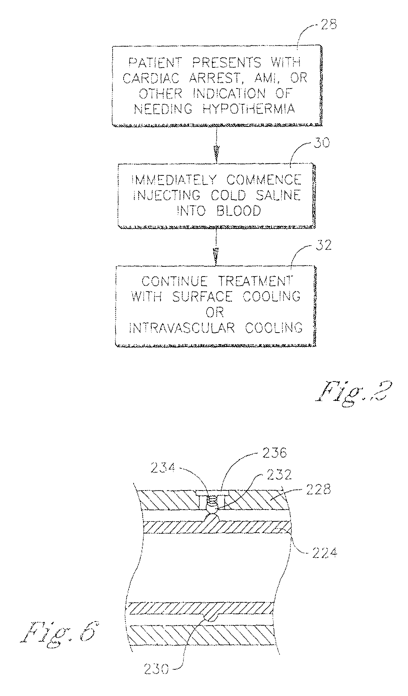 External heat exchange pad for patient