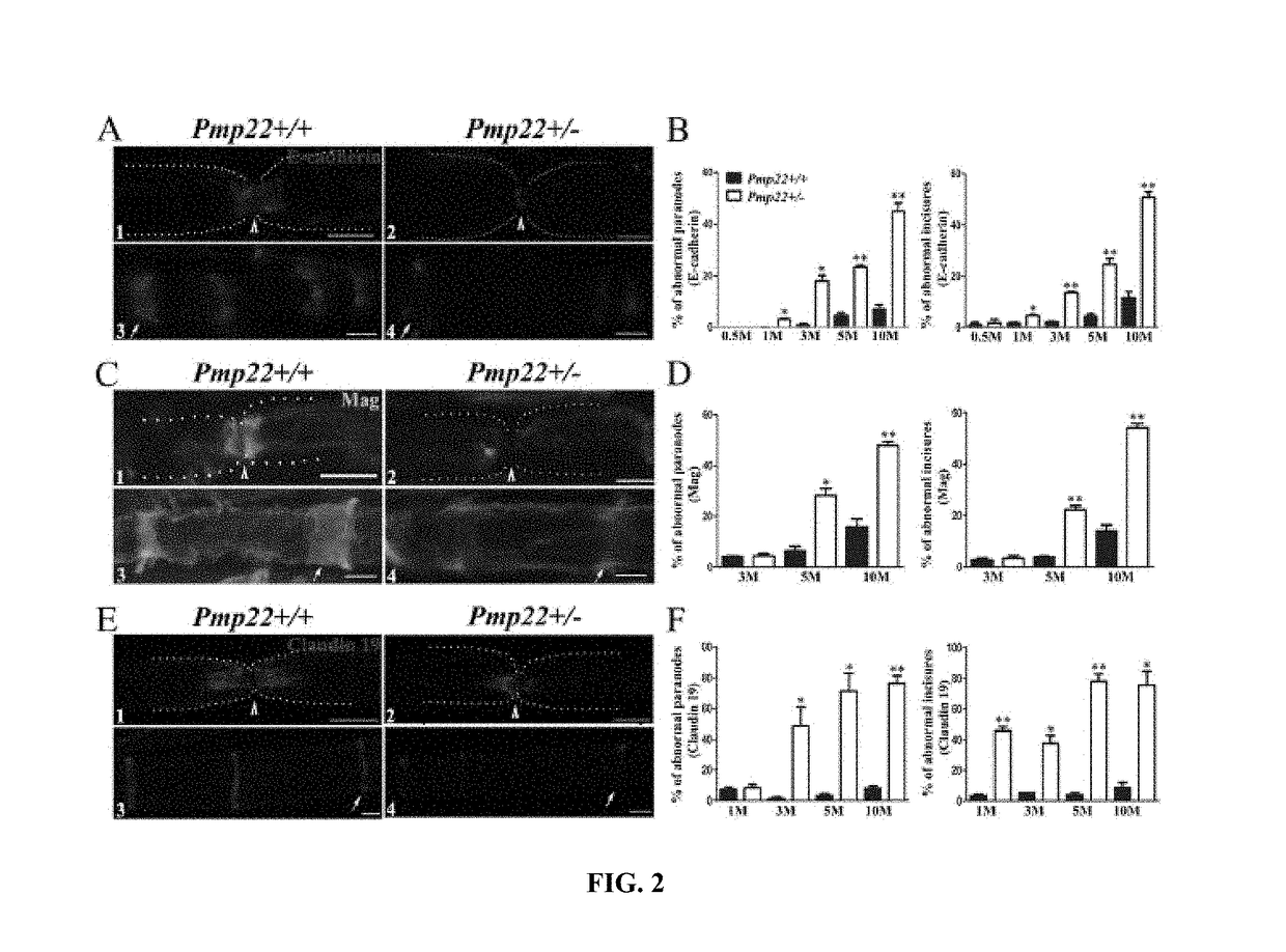 Treatment for hereditary neuropathy with liability to pressure palsies (HNPP)