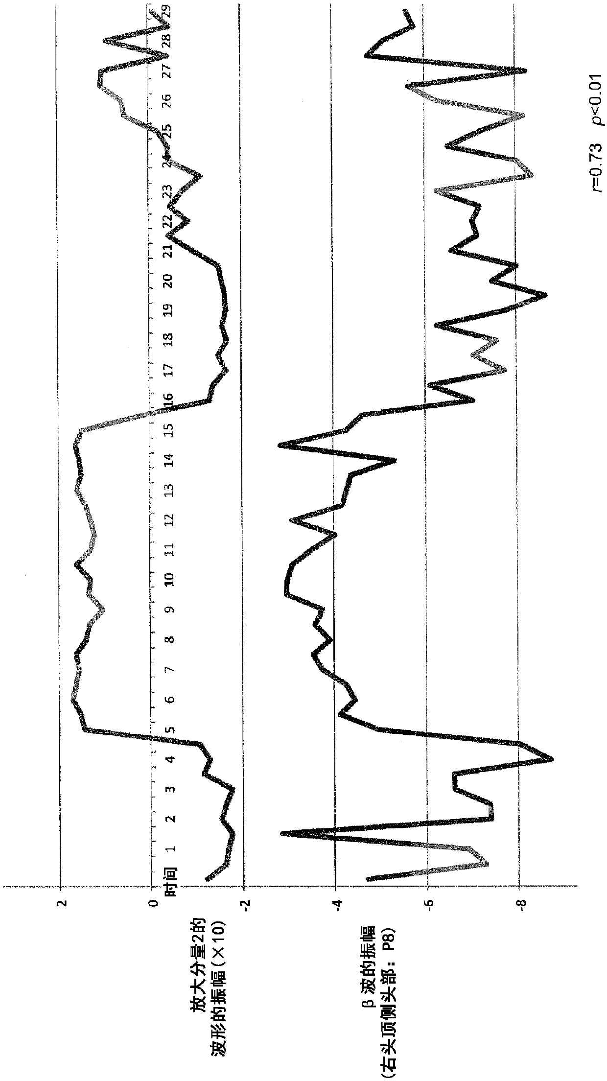 Brain-activity estimation device