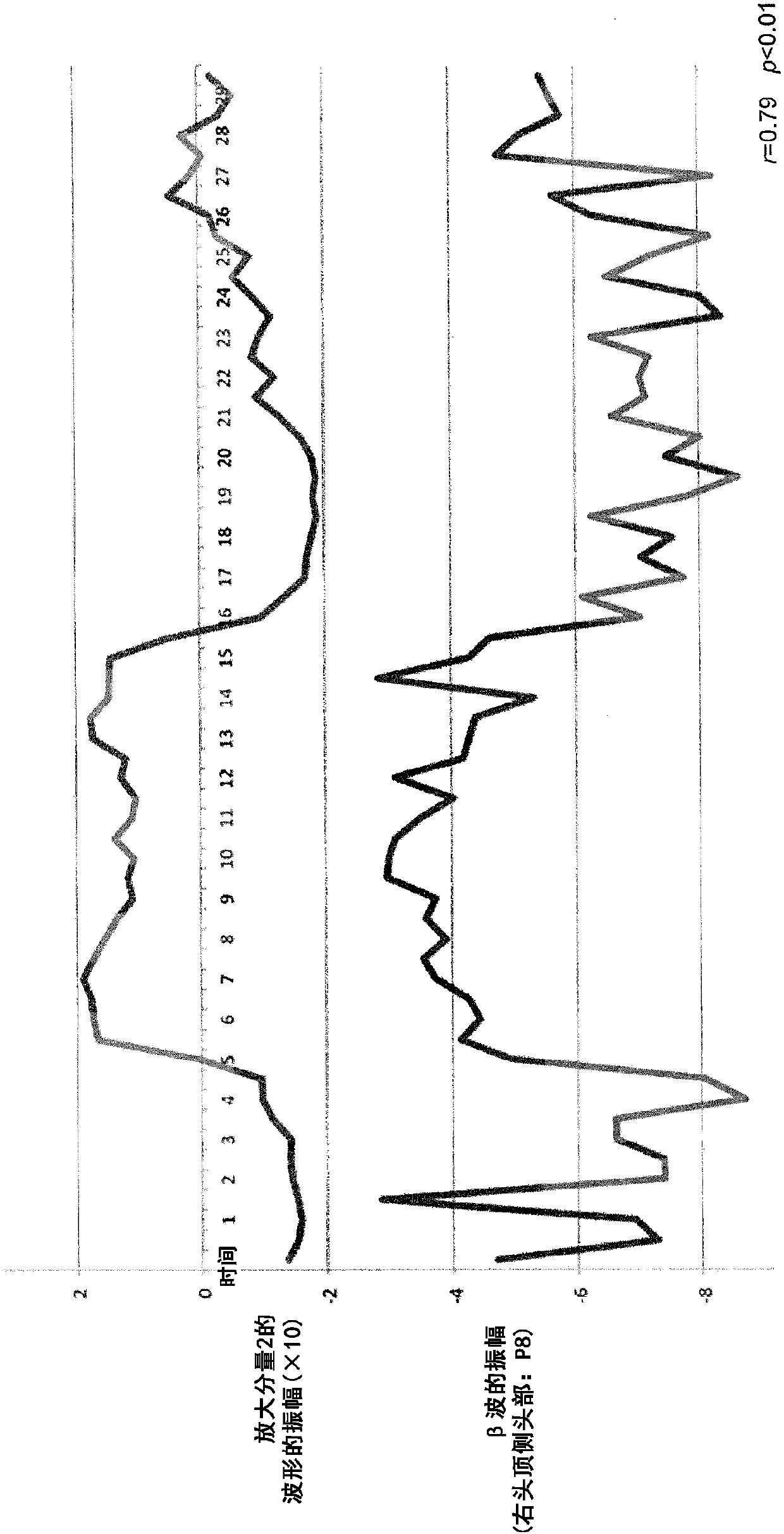 Brain-activity estimation device