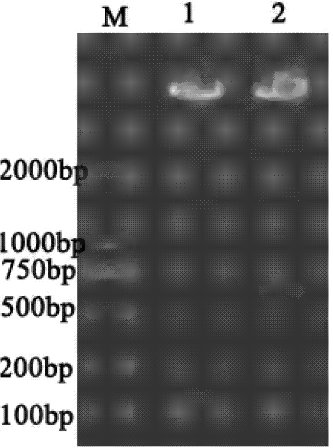 Hybridoma cell strain generating anti-human NGAL specific monoclonal antibody, monoclonal antibody generated by same and application