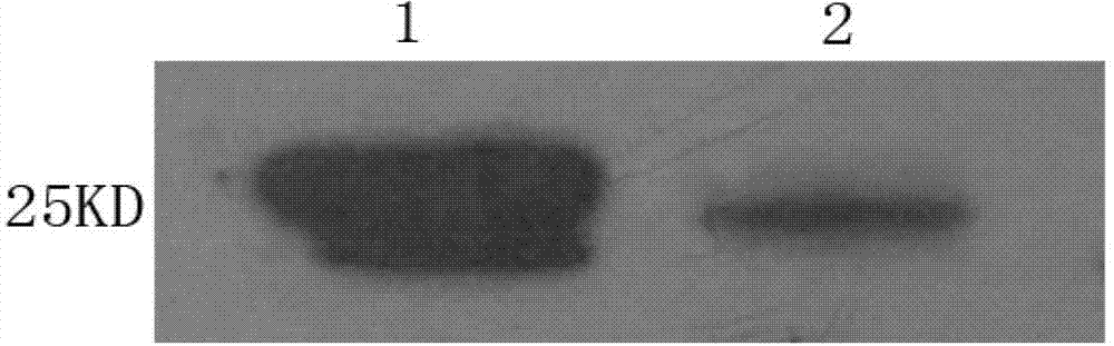 Hybridoma cell strain generating anti-human NGAL specific monoclonal antibody, monoclonal antibody generated by same and application