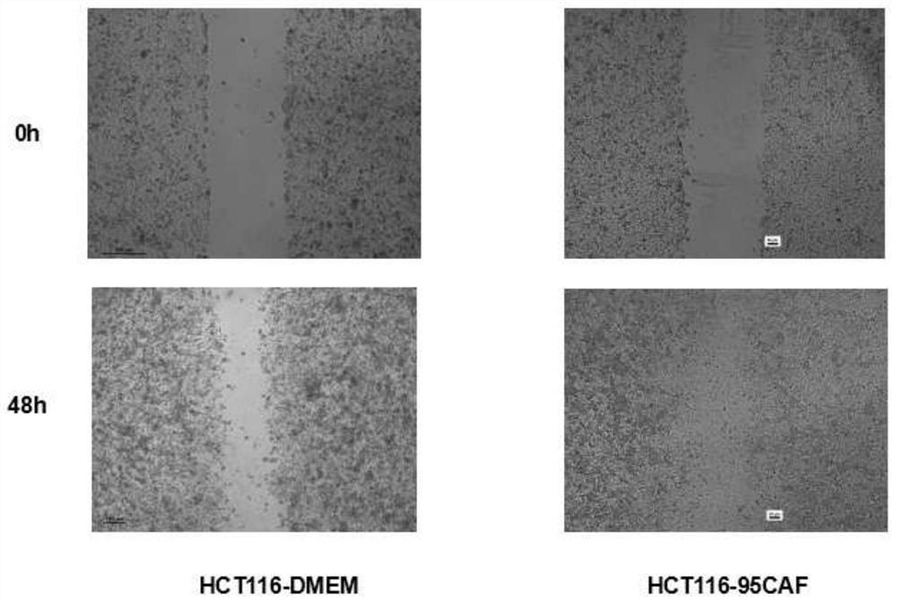 Human tumor-associated fibroblast cell lines and application thereof